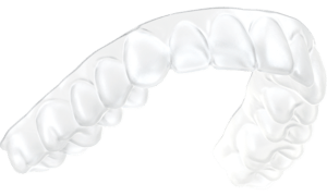 suresmile aligner