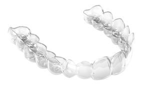 alineadores spark - Ortodoncia Invisible Castellón - Almela Clínica Dental, Castellón
