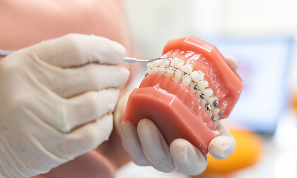 Ortodoncia Brackets Castellón - Almela Clínica Dental, Castellón