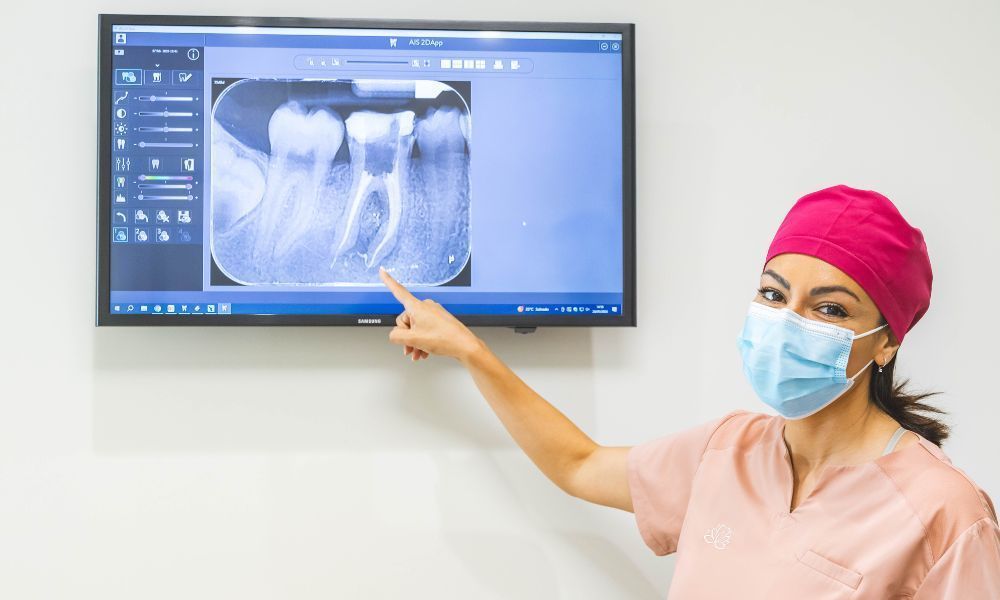 IMPLANTES 1 Nuria Almela