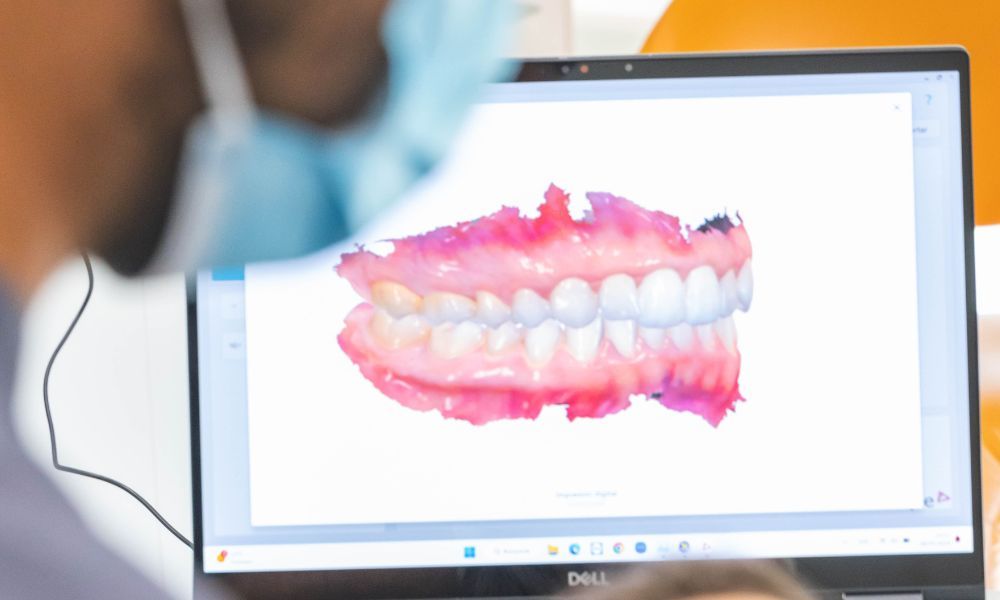 Ortodoncia - Almela Clínica Dental, Castellón
