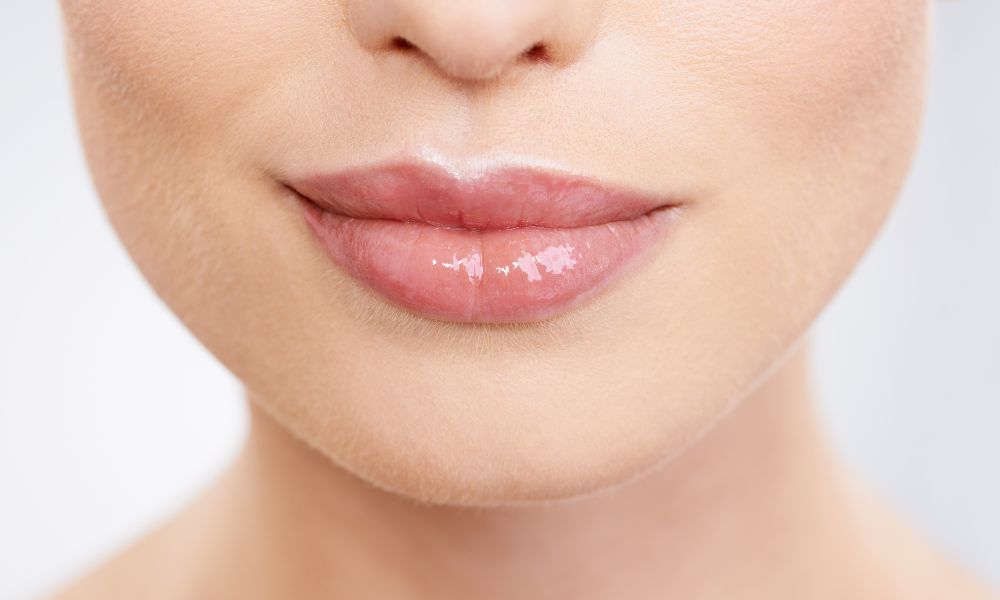 Ácido Hialurónico Labios- Almela Clínica Dental, Castellón