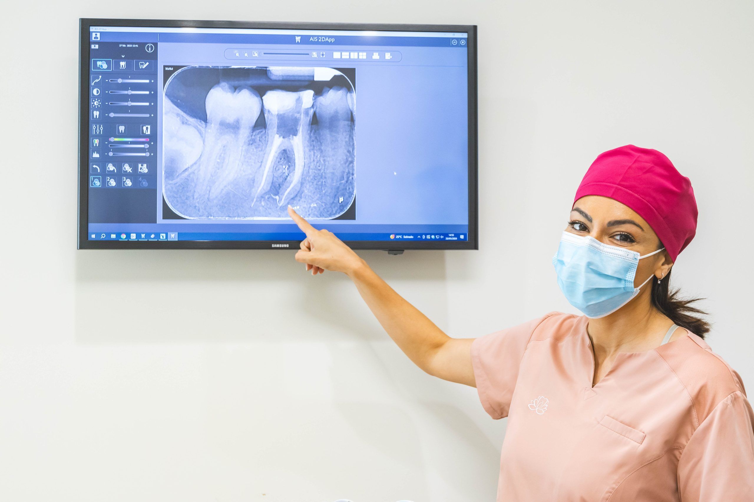 Clinica Almela Dental Endodoncia 1
