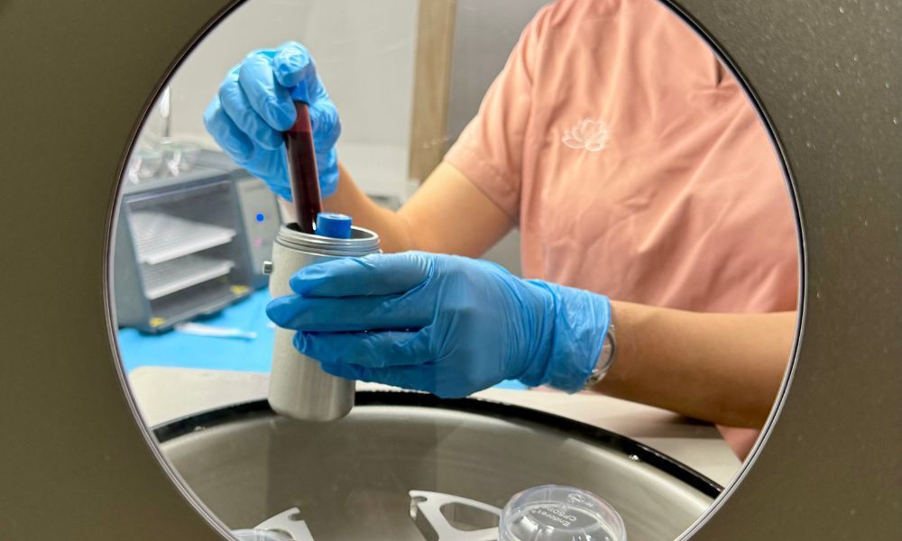 ESTETICA PLASMA - Almela Clínica Dental, Castellón