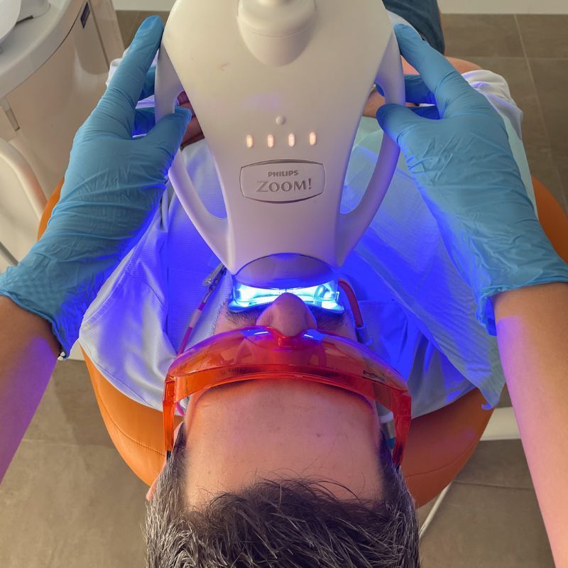 Blanqueamiento zoom, Philips - Almela Clínica Dental, Castellón