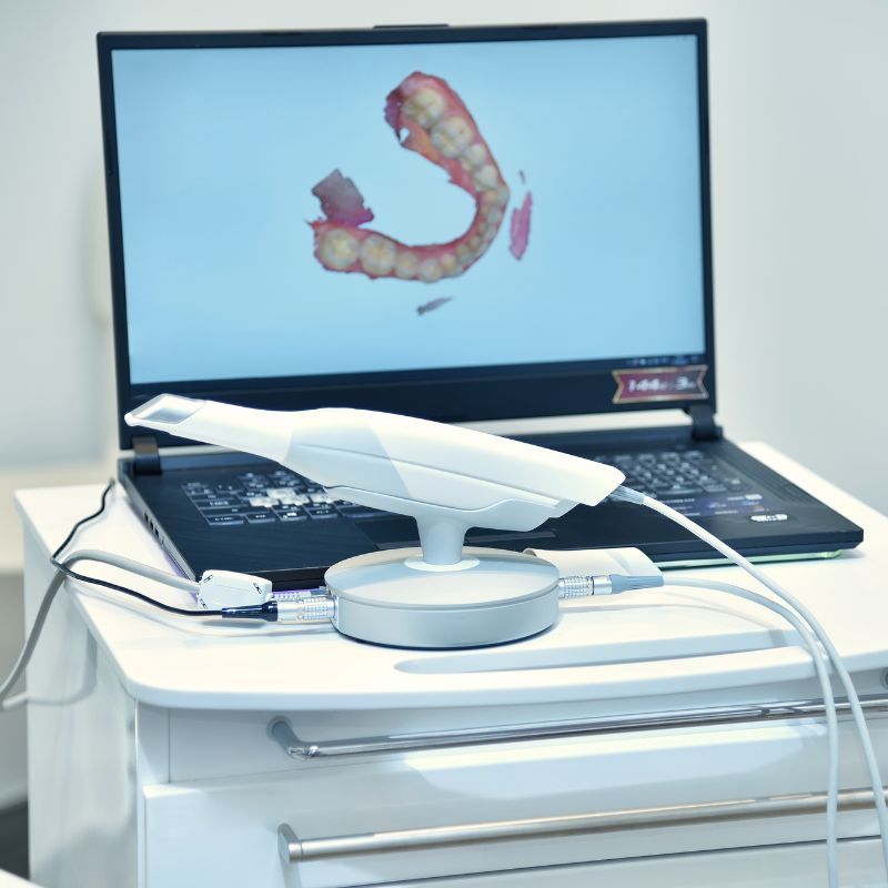 Escaner digital - Almela Clínica Dental, Castellón