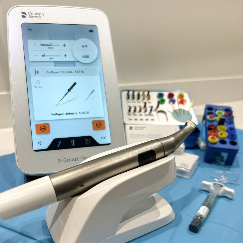 Tecnología en endodoncia - Almela Clínica Dental