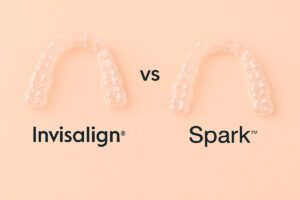Sistemas de ortodoncia invisible Castellón Invisalign Vs Spark Clínica Almela