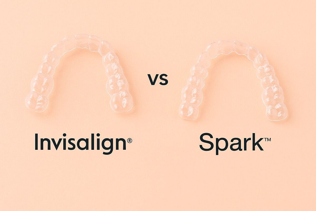 Sistemas de ortodoncia invisible Castellón Invisalign Vs Spark Clínica Almela