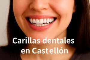 Carillas dentales en Castellón – Almela Clínica Dental Carillas dentales en Castellón – Almela Clínica Dental
