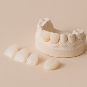 Carillas o fundas dentales Clínica Dental Almela Castellón